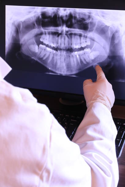 Best Emergency Root Canal Treatment in West Bradenton, FL